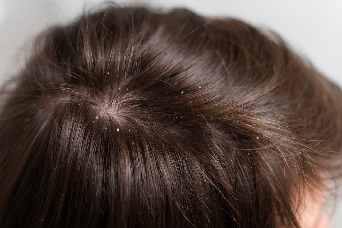 Cyclical Hair Therapy Benefits: How It Improves Women's Scalp Health